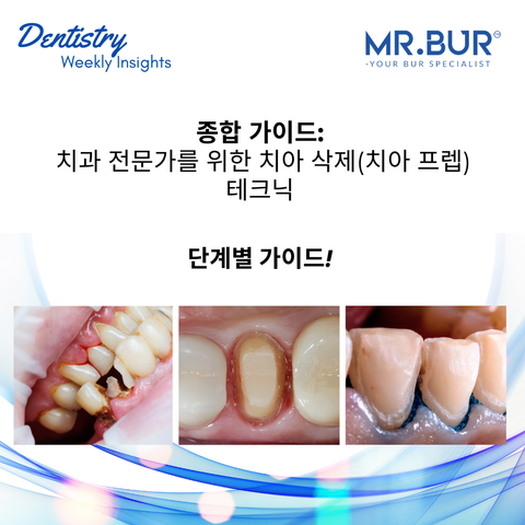 Mr. Bur comprehensive guide to tooth preparation techniques for dental professionals covering clinical steps material choice bur selection and precision outcomes.