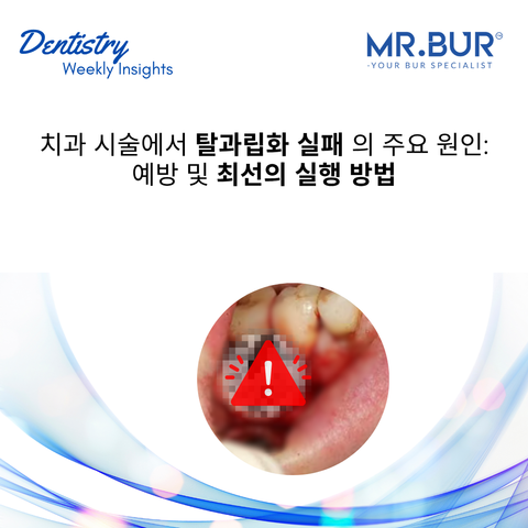 Mr. Bur blog article titled 'Top Reasons for Degranulation Failure in Dental Procedures: Prevention and Best Practices' offering expert insights on tissue removal techniques and success strategies in dentistry.