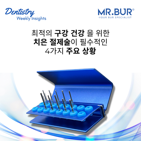Image show the Best Mr Bur gingivectomy burs specialize for gum trimming and tissue adjustment.