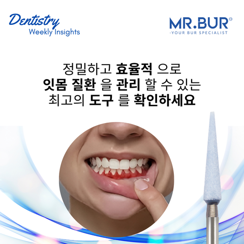 잇몸 질환을 정밀하고 효율적으로 관리할 수 있는 최고의 도구를 확인하세요
