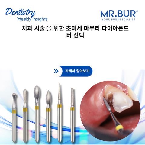 치과 시술에 적합한 초미세 마감 다이아몬드 버 선택하기