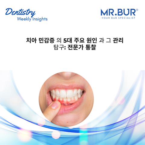 Mr Bur explores 5 major causes of tooth sensitivity and their management offering professional insights for effective dental care solutions.