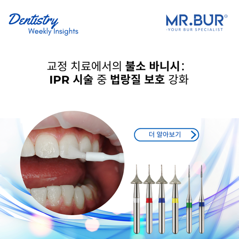 Mr. Bur explores fluoride varnish in orthodontic care, enhancing enamel protection during IPR treatments for optimal patient outcomes.
