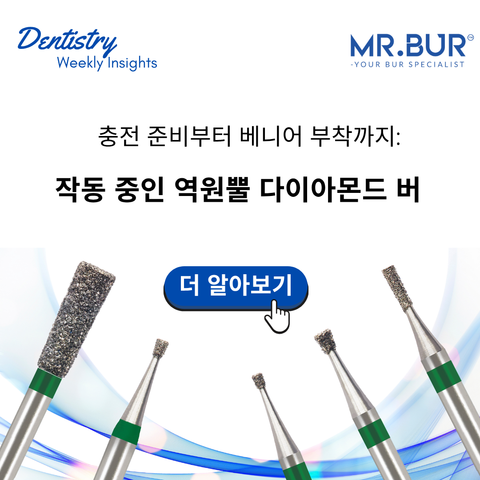 캐비티 준비에서 베니어 배치까지: 인버티드 콘 다이아몬드 버 작동