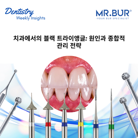  Black triangles in dentistry explained, addressing causes like periodontal disease, orthodontic factors, restorative errors, and implant placement, with solutions featuring Mr. Bur tools.
