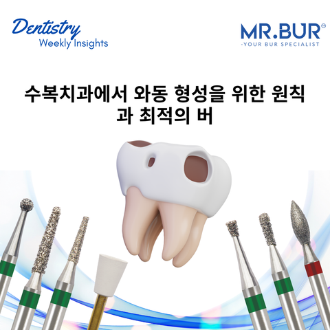 Discover the principles and top burs from Mr. Bur for precise cavity preparation in restorative dentistry, ensuring optimal outcomes.