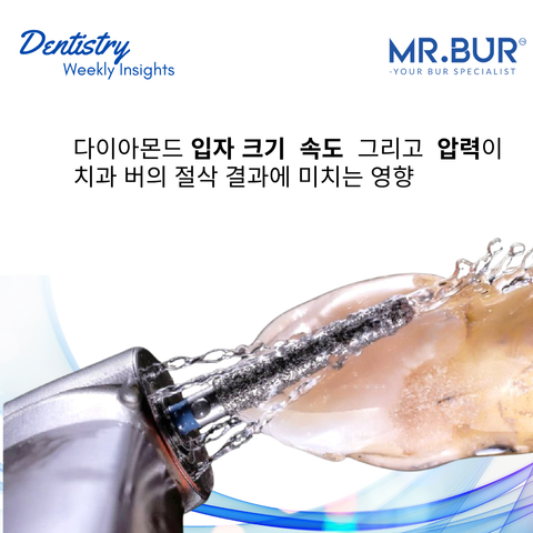 This image shows the method of maximizing dental bur performance: diamond grit, speed, and pressure.