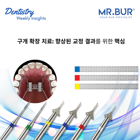 Mr. Bur highlights palatal expansion treatment as a crucial step for enhanced orthodontic outcomes, improving alignment and jaw symmetry.