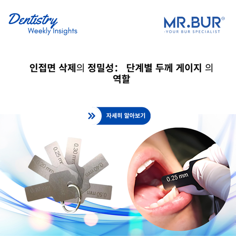 Mr. Bur highlights the role of incremental thickness gauges in achieving precision and accuracy during interproximal reduction procedures.