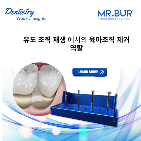 Cover image highlighting the role of Mr. Bur Degranulation Kit in achieving precision and success in Guided Tissue Regeneration procedures.