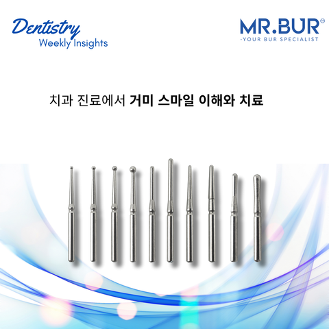 Mr. Bur explores causes of gummy smile, highlighting underlying factors such as excessive gingival display, short upper lip, and altered eruption.