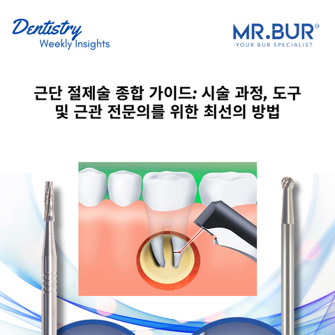 근단절제술 종합 가이드: 근관 전문의를 위한 시술 과정, 기구 및 최신 임상 원칙