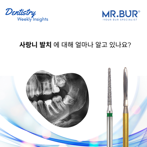 사랑니 발치에 대해 얼마나 알고 있습니까?