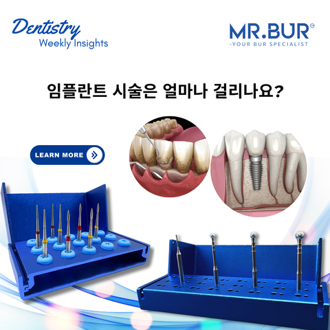 임플란트 시술은 얼마나 걸리나요?