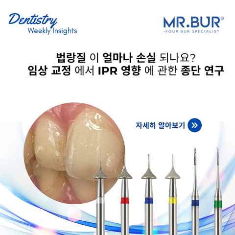 How Much Enamel Is Lost A Longitudinal Study on IPR’s Impact in Clinical Orthodontics, exploring enamel reduction, safety, and outcomes with Mr. Bur One Slice IPR Kit.